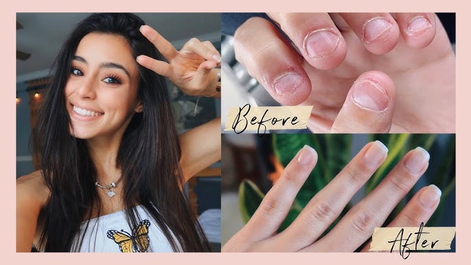 Stop'n Grow Stop Biting Nail Solution
