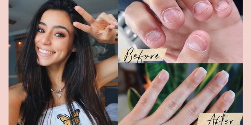 Stop’n Grow Stop Biting Nail Solution – Anti-Bite Nail Treatment For Adults & Children